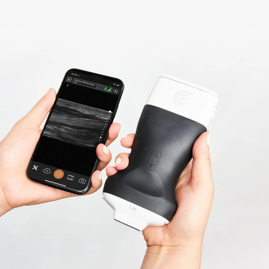 Clarius Portable Aesthetic Ultrasound