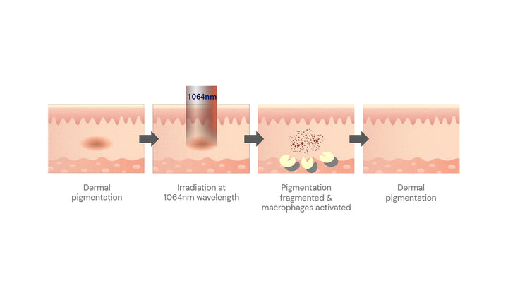 Pastel Injection Pastelle – Cryomed Aesthetics
